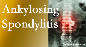 Ankylosing spondylitis is gently cared for by your Pflugerville chiropractor.