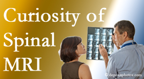 Pflugerville MRIs for spinal stenosis may be revealing…or puzzling.
