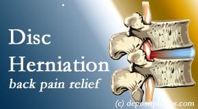 Pflugerville Wellness Center uses non-surgical treatment for relief of disc herniation related back pain. 