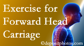 Pflugerville chiropractic treatment of forward head carriage is two-fold: manipulation and exercise.