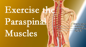 Pflugerville Wellness Center explains the importance of paraspinal muscles and their strength for Pflugerville back pain relief.