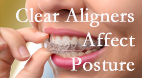 Clear aligners influence posture which Pflugerville chiropractic helps.