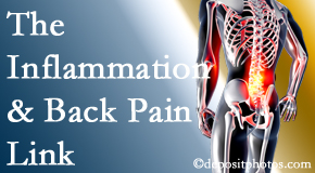 Pflugerville Wellness Center tackles the inflammatory process that accompanies back pain as well as the pain itself.