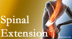 Pflugerville Wellness Center knows the role of extension in spinal motion, its necessity, its benefits and potential harmful effects. 