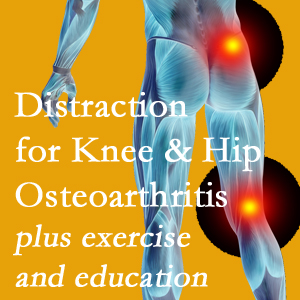 A chiropractic treatment plan for Pflugerville knee pain and hip pain due to osteoarthritis: education, exercise, distraction.